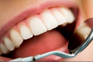 Manfaat Madu untuk Mengobati Gigi Berlubang Secara Alami